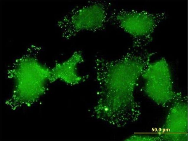Monoclonal Anti-LSM3 antibody produced in mouse