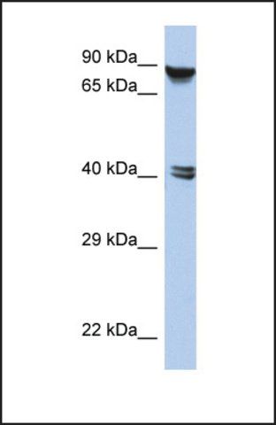 Anti-ZNF429, (N-terminal) antibody produced in rabbit