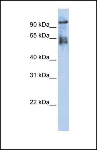 Anti-ZNF43 antibody produced in rabbit