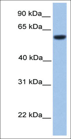 Anti-ZNF545 (AB2) antibody produced in rabbit