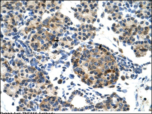 Anti-ZNF555 (AB2) antibody produced in rabbit