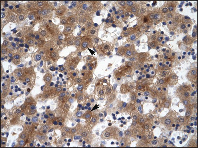Anti-ZNF551 antibody produced in rabbit