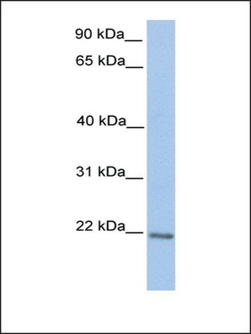 Anti-ZNF548 (AB2) antibody produced in rabbit
