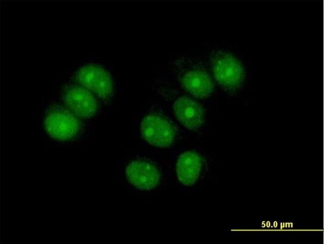 Anti-ZNF554 antibody produced in mouse