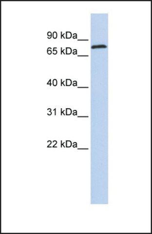 Anti-ZNF613, (N-terminal) antibody produced in rabbit