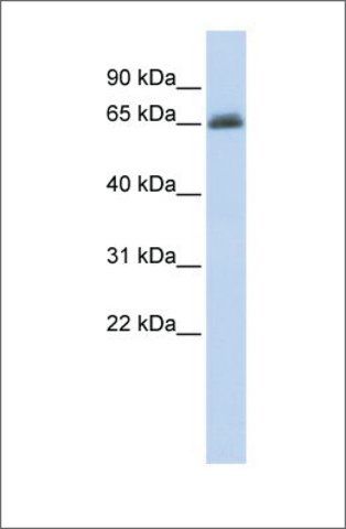 Anti-UGT2B15 antibody produced in rabbit