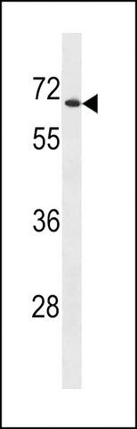 ANTI-UGT2B28 (CENTER) antibody produced in rabbit