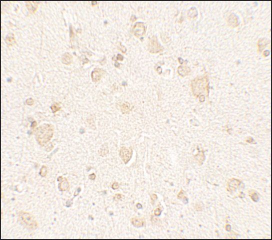 Anti-ULK4 antibody produced in rabbit