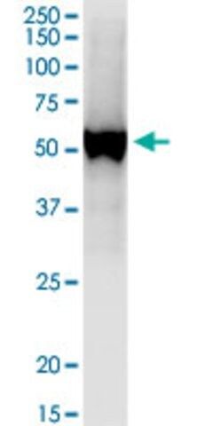 Anti-UGT1A7 antibody produced in mouse