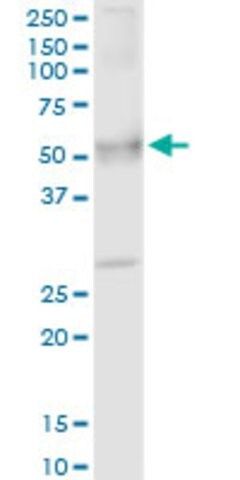 Anti-UMOD antibody produced in rabbit