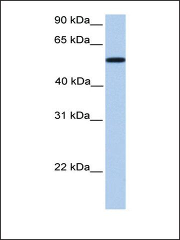 Anti-UGT2A3 (AB2) antibody produced in rabbit