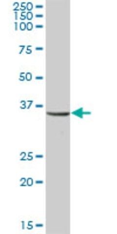 Anti-UMPS antibody produced in mouse