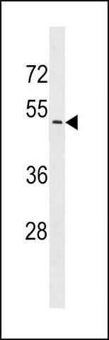 ANTI-UGT2B7 (N-TERM) antibody produced in rabbit