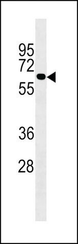 ANTI-UGT2B10(C-TERMINAL) antibody produced in rabbit