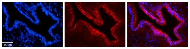 Anti-UMPS antibody produced in rabbit