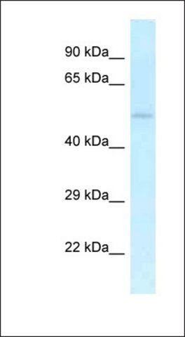 Anti-UHMK1 antibody produced in rabbit