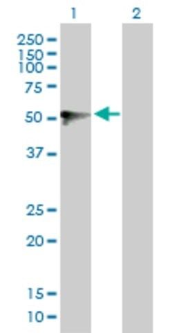 Anti-UGT1A9 antibody produced in rabbit
