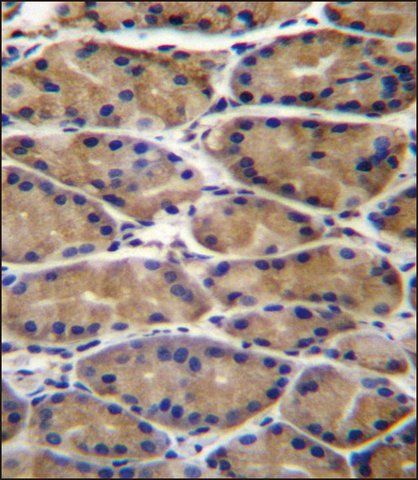 ANTI-UPRT (C-TERM) antibody produced in rabbit