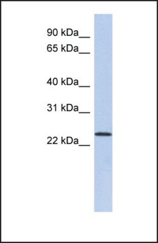 Anti-ULBP1, (N-terminal) antibody produced in rabbit