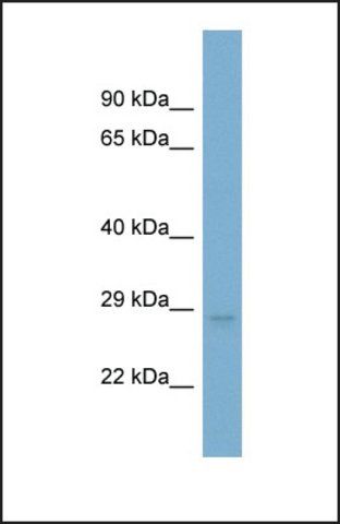 Anti-UQCRFS1, (N-terminal) antibody produced in rabbit