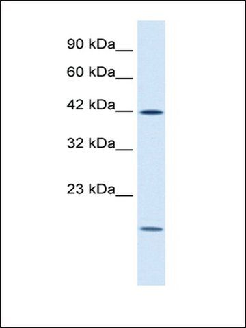 Anti-USF1 (AB2) antibody produced in rabbit