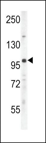 ANTI-UNK (N-TERMINAL) antibody produced in rabbit