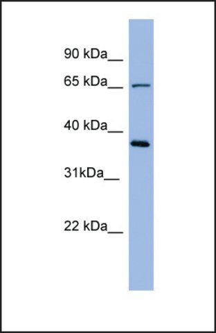 Anti-UMOD antibody produced in rabbit