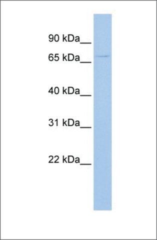 Anti-UGT3A2 antibody produced in rabbit