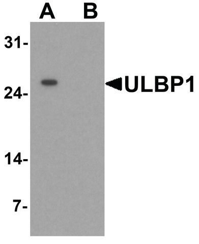 Anti-ULBP1 antibody produced in rabbit