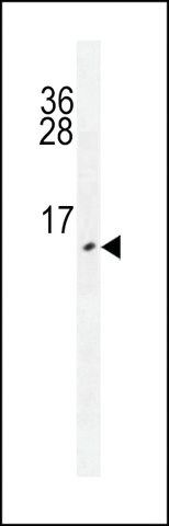ANTI-URM1 antibody produced in mouse