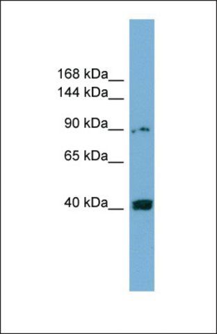 Anti-UNC5C antibody produced in rabbit
