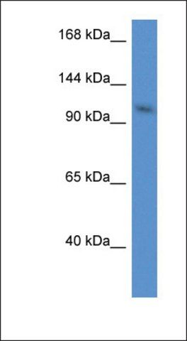 Anti-URGCP antibody produced in rabbit