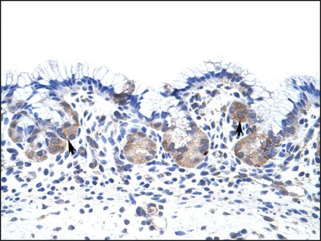 Anti-UPF3B antibody produced in rabbit