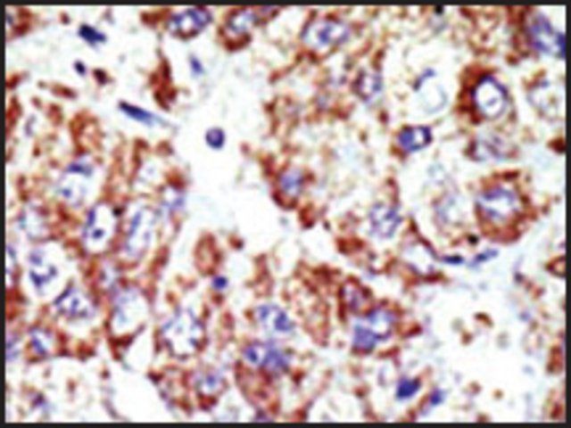 Anti-USP28 (N-term) antibody produced in rabbit