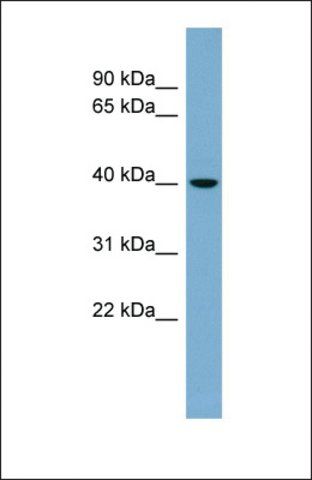 Anti-VPS37C, (N-terminal) antibody produced in rabbit