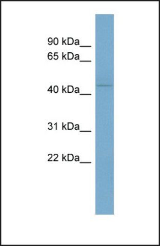 Anti-VDR, (N-terminal) antibody produced in rabbit