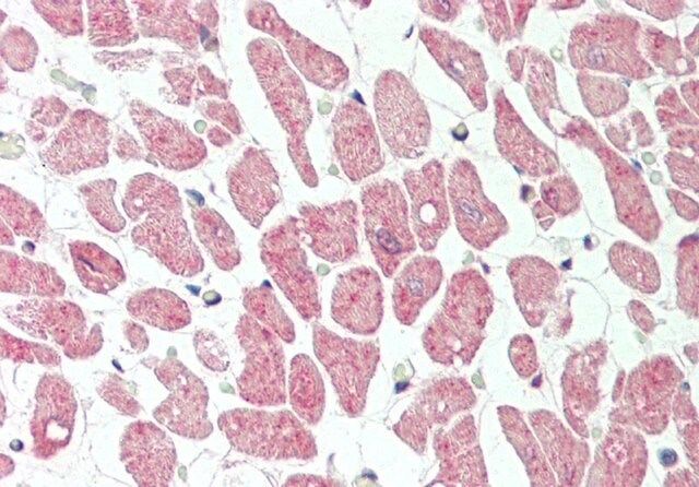 Anti-VPS29, (N-terminal) antibody produced in rabbit