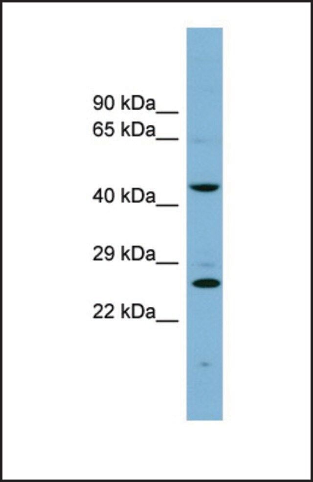 Anti-VPS28, (N-terminal) antibody produced in rabbit