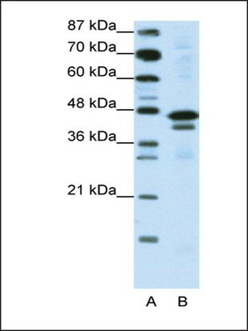 Anti-WDR39 (AB1) antibody produced in rabbit