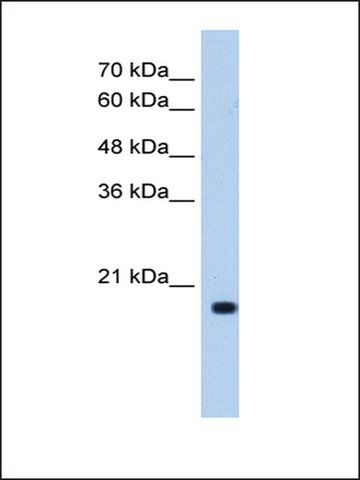 Anti-XTP3TPA (AB2) antibody produced in rabbit