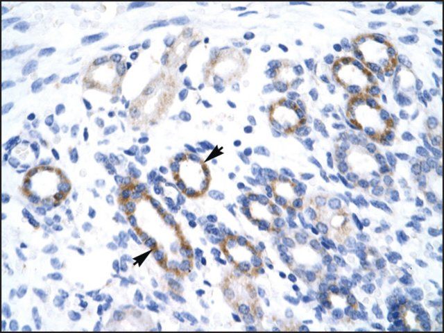 Anti-YBX2 antibody produced in rabbit