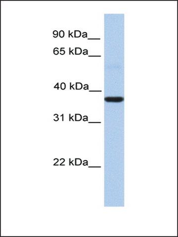Anti-ZC3H15 antibody produced in rabbit