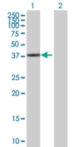 Anti-SPO11 antibody produced in mouse