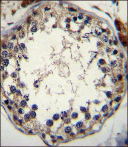 ANTI-STRA8 (C-TERM) antibody produced in rabbit