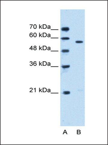 Anti-STK3 antibody produced in rabbit