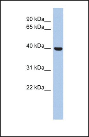 Anti-STOML3, (N-terminal) antibody produced in rabbit