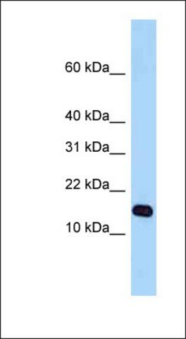 Anti-STH antibody produced in rabbit