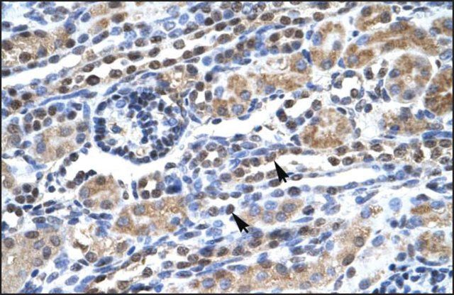 Anti-SUPT5H antibody produced in rabbit