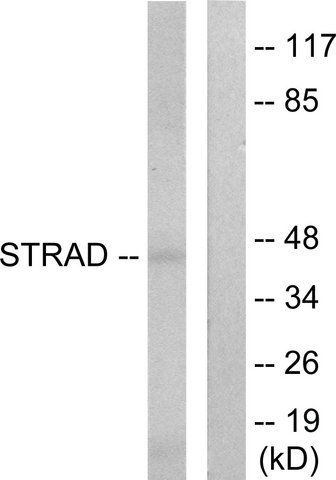 Anti-STRAD antibody produced in rabbit