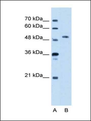 Anti-STK39 (ab2) antibody produced in rabbit
